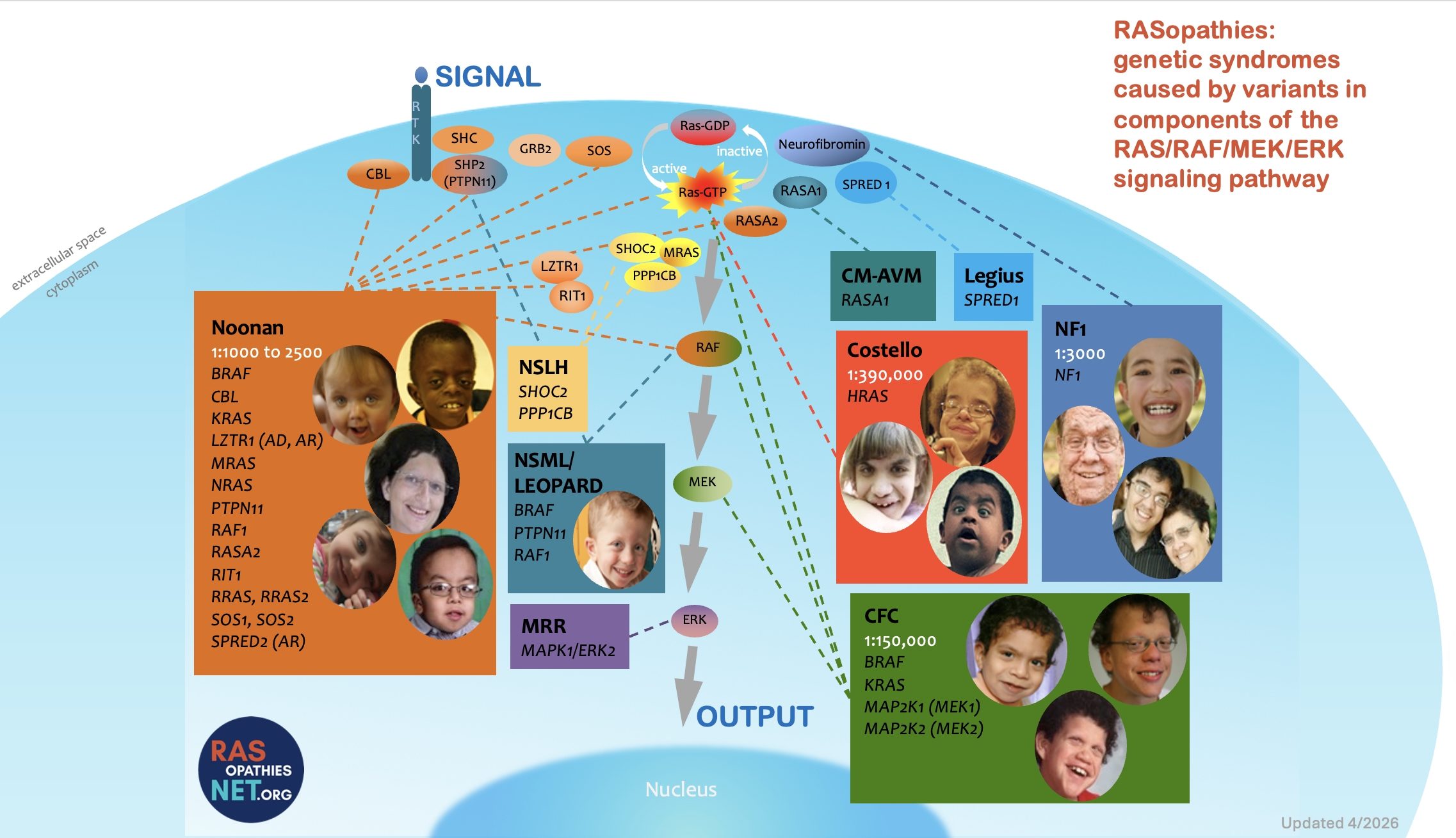 RASopathies are genetic conditions caused by variants in the RAS/RAF/MEK/ERK signaling pathway